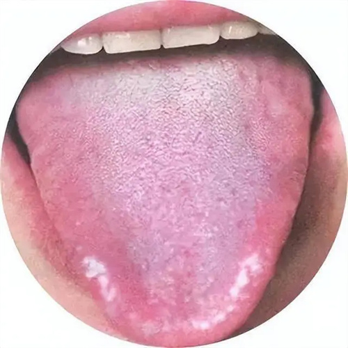 详细介绍
